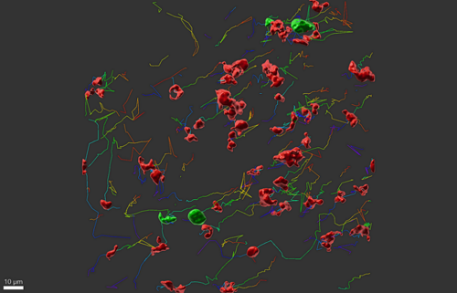 Computergenerierte Lasermikroskopaufnahme wenige mykrometer großer Strukturen des Immunsystems mit roten und grünen Körpern und mehrfarbigen anhängenden Fäden